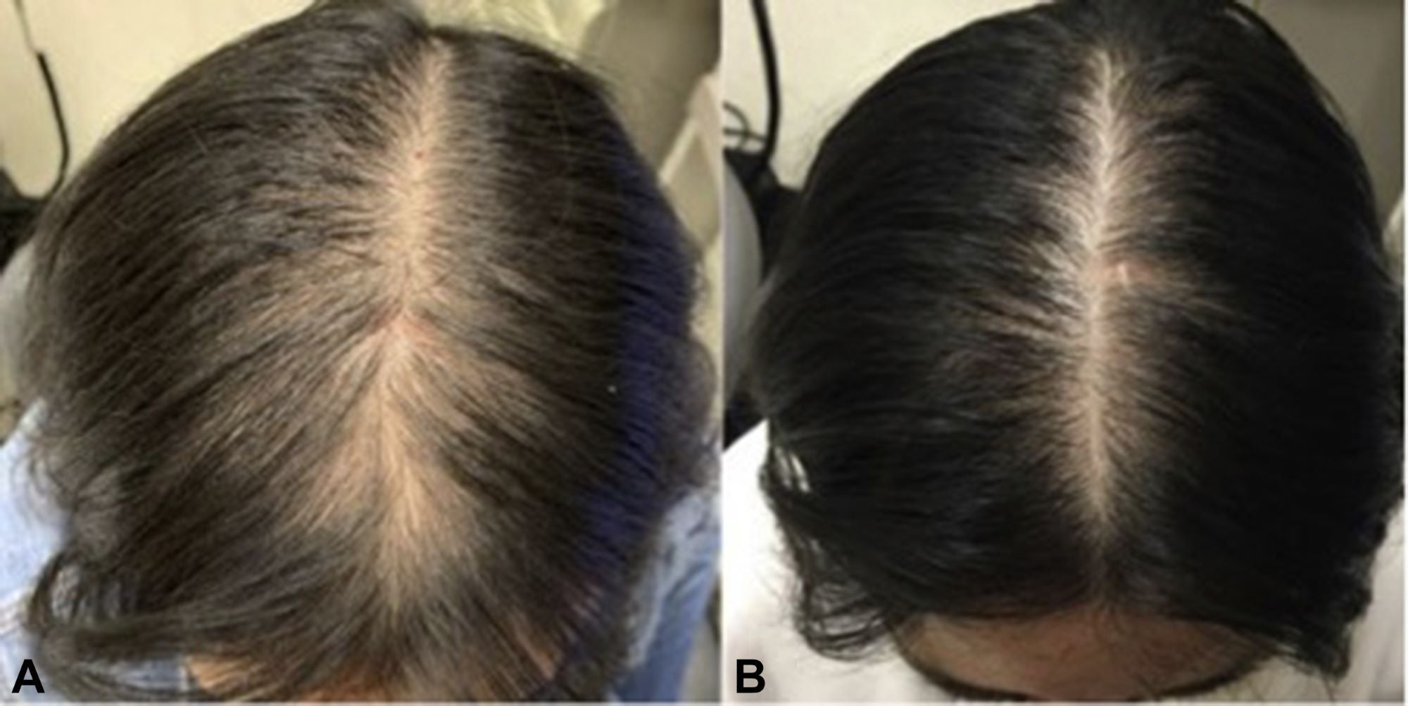 WHOLESALE-HAIR CARE-PRIVATE LABELS- (4 Gallons)  SHAMPOO-CONDITIONER- Hair GROWTH OIL-GROWTH SERUM-with Peppermint Oil, Tea Tree Oil, Argan oil, Jojoba seed, Avocado oil, Castor oil, Sweet Almond, Vitamin E Oil for Scalp and Hair